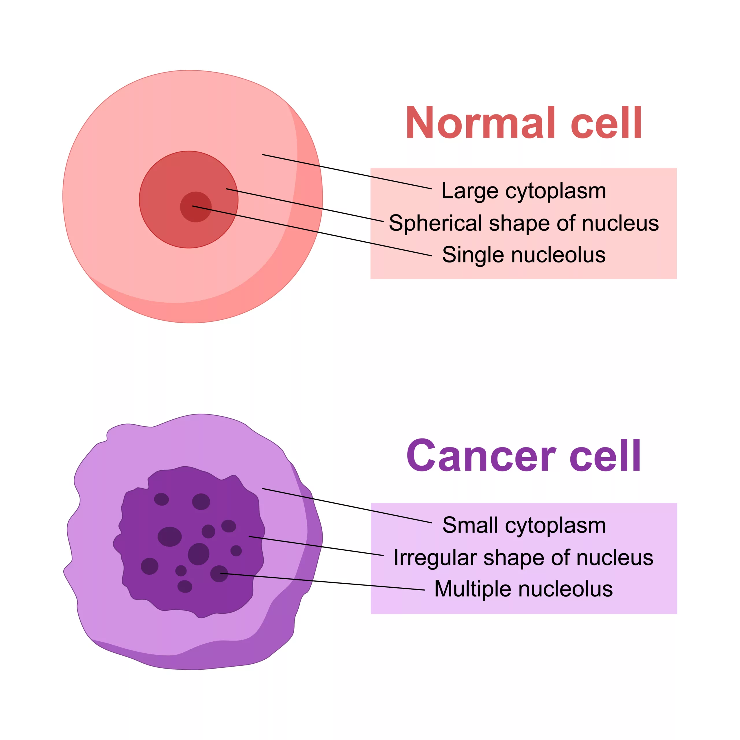 Differences Between Normal and Cancer Cells A side-by-side illustration comparing a normal cell and a cancer cell. The normal cell is shown in pink with a large cytoplasm, a round nucleus, and a single nucleolus. The cancer cell is depicted in purple with a small cytoplasm, an irregular-shaped nucleus, and multiple nucleoli.