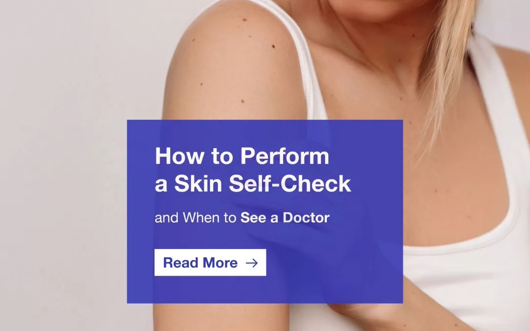 How to Perform a Skin Self-Check (And When to See a Doctor)