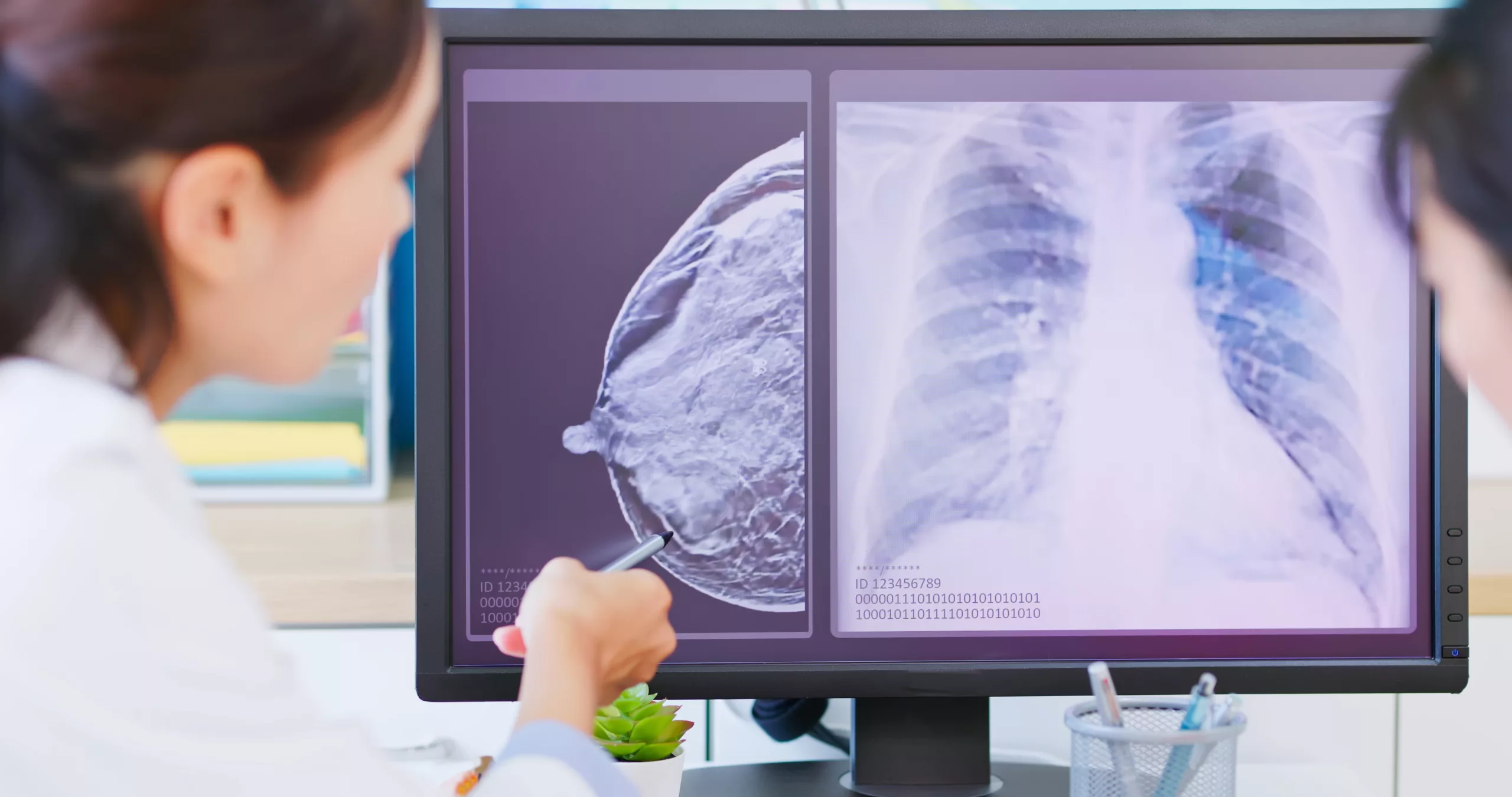 Reviewing breast imaging and diagnostic results A provider reviews a digital mammogram and chest image on a computer screen, pointing out key details to a patient during a breast cancer consultation.