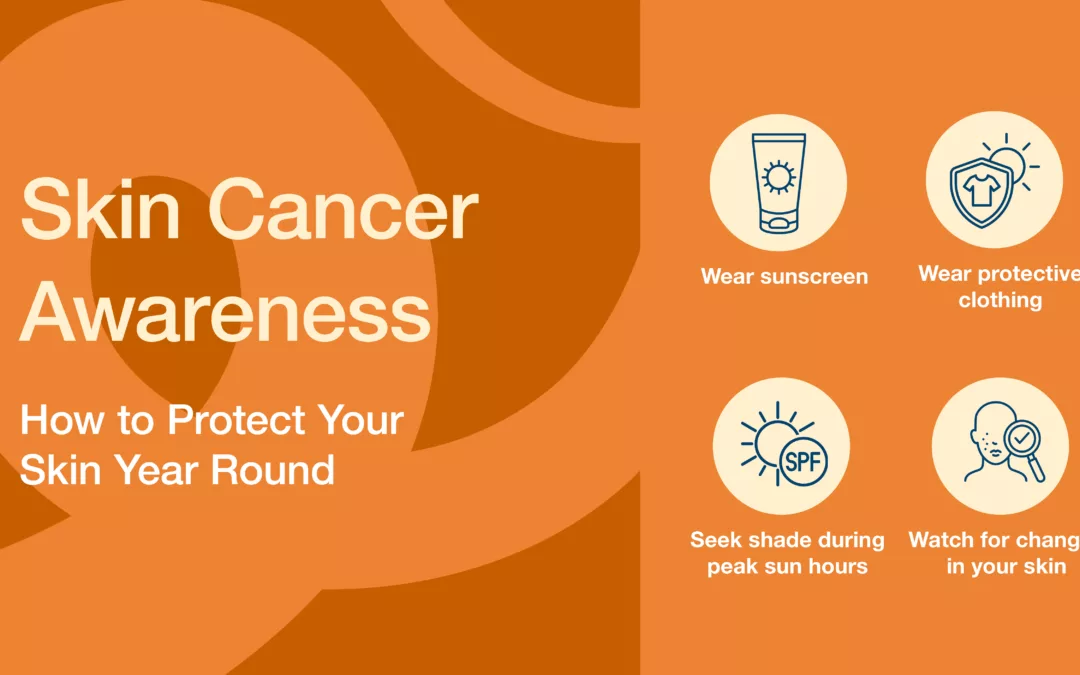 Skin Cancer Awareness: How to Protect Your Skin Year Round