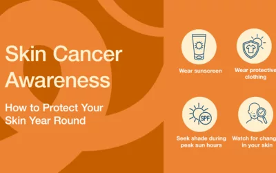 Skin Cancer Awareness: How to Protect Your Skin Year Round